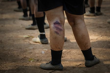 tagreuters.com2024binary_LYNXMPEK7M01K-VIEWIMAGE