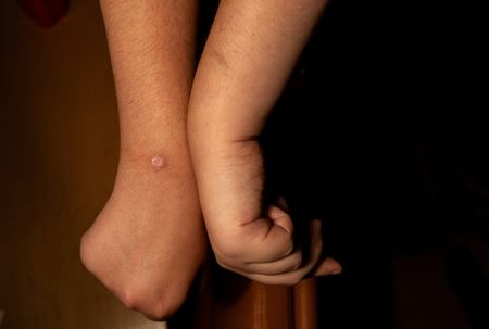 tagreuters.com2024binary_LYNXMPEK4G0G3-VIEWIMAGE